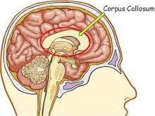 corpus collosum